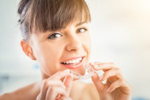 why choose invisalign 5 points advanced dentistry